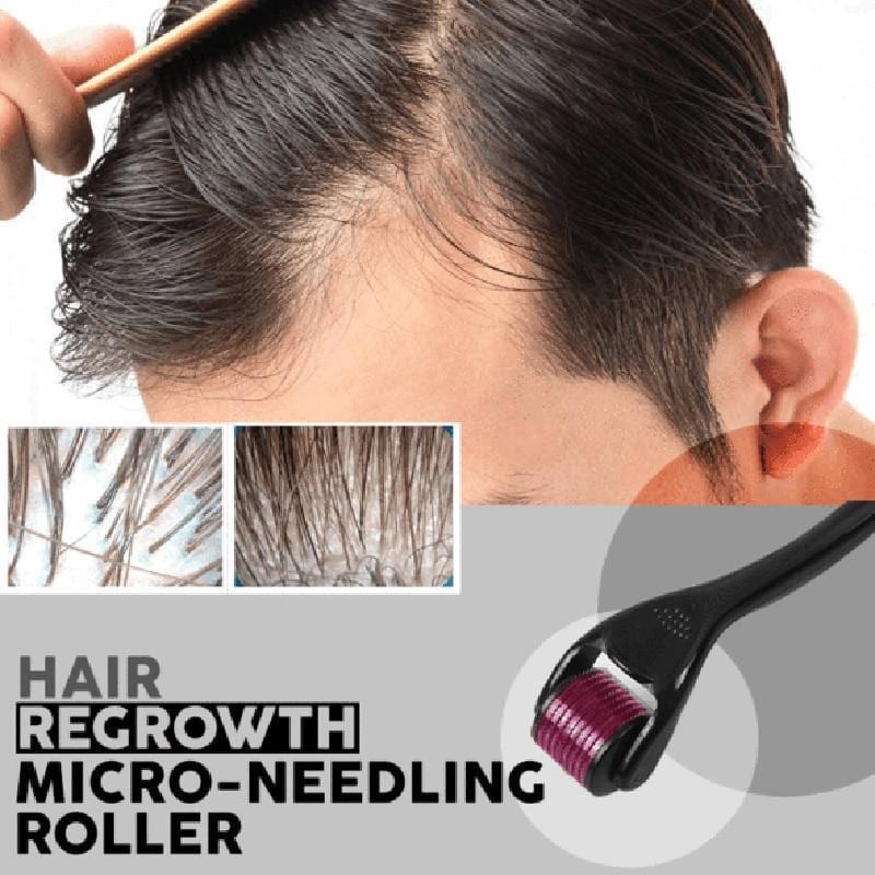 Microneedling roller - Потикнува раст на косата
